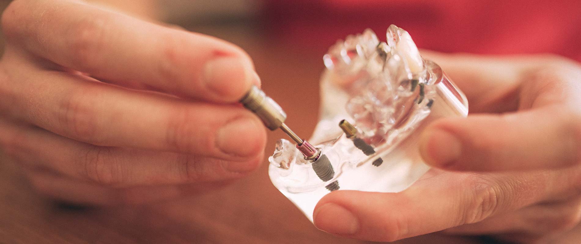Zahnärztin schraubt ein Zahnimplantat in ein Gebissmodell. 