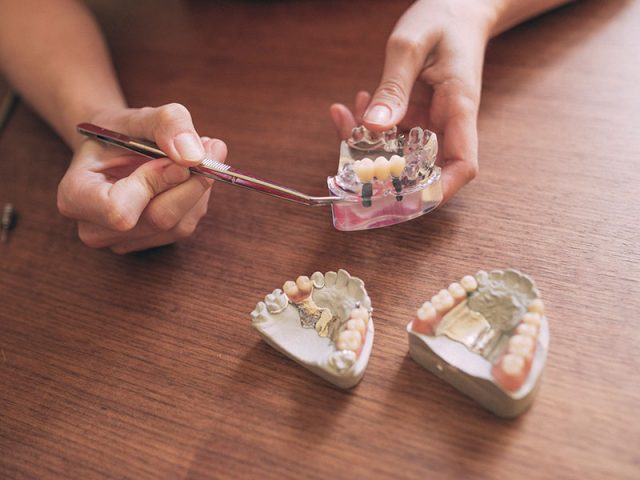 Zahnärztin erklärt Zahnimplantate anhand eines Modells.