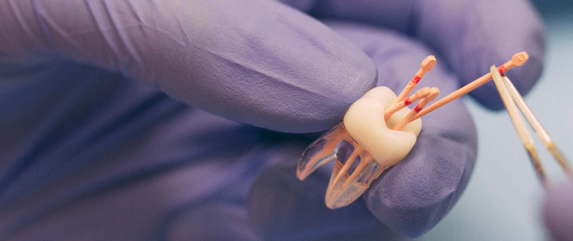 Zahnärztin erklärt Wurzelbehandlung mit Hilfe eines Zahnmodells. 